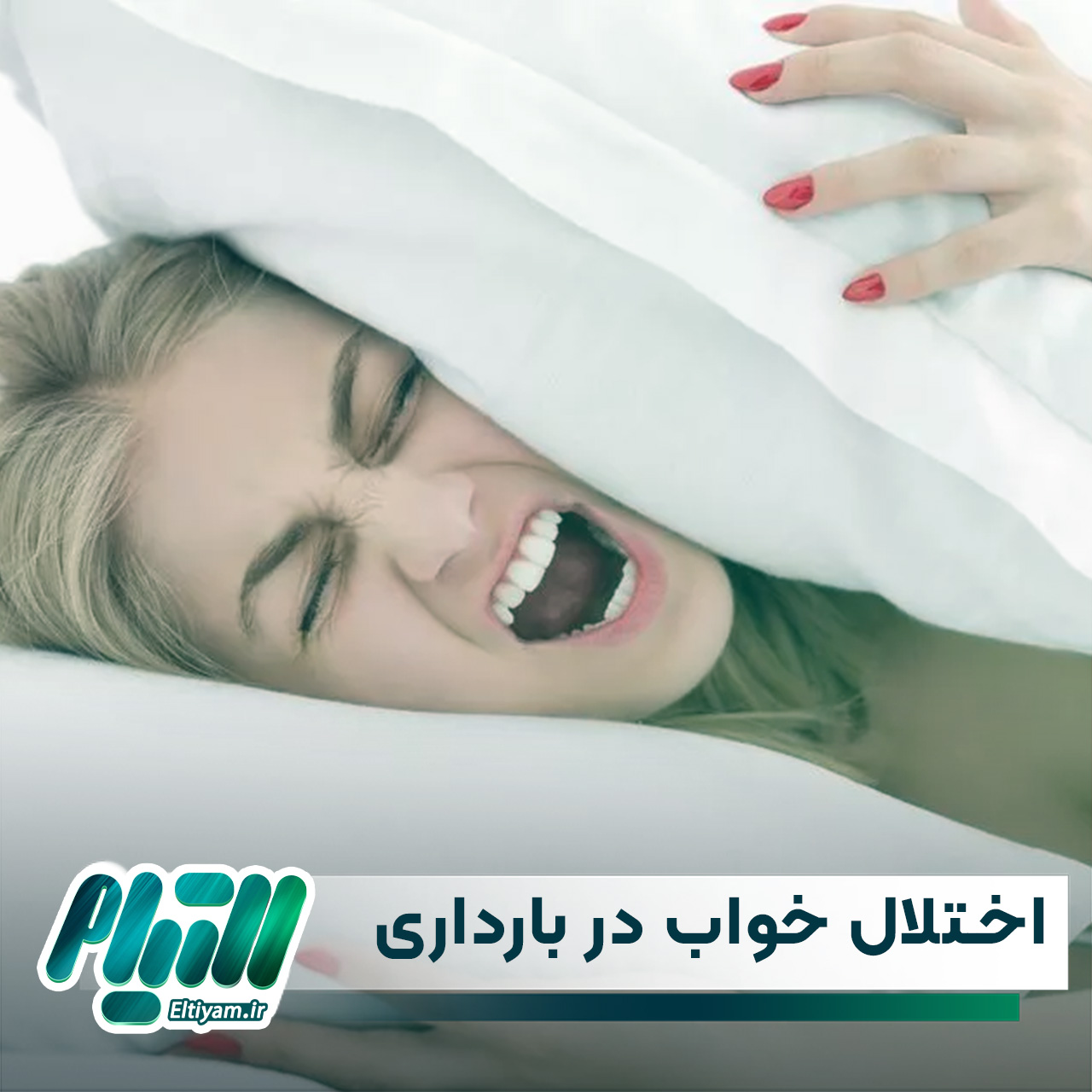 اختلال خواب در بارداری