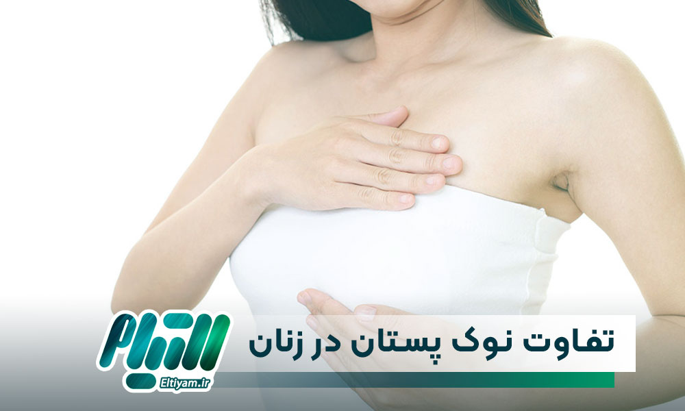 اطلاعاتی در مورد تفاوت شکل ظاهری نوک پستان