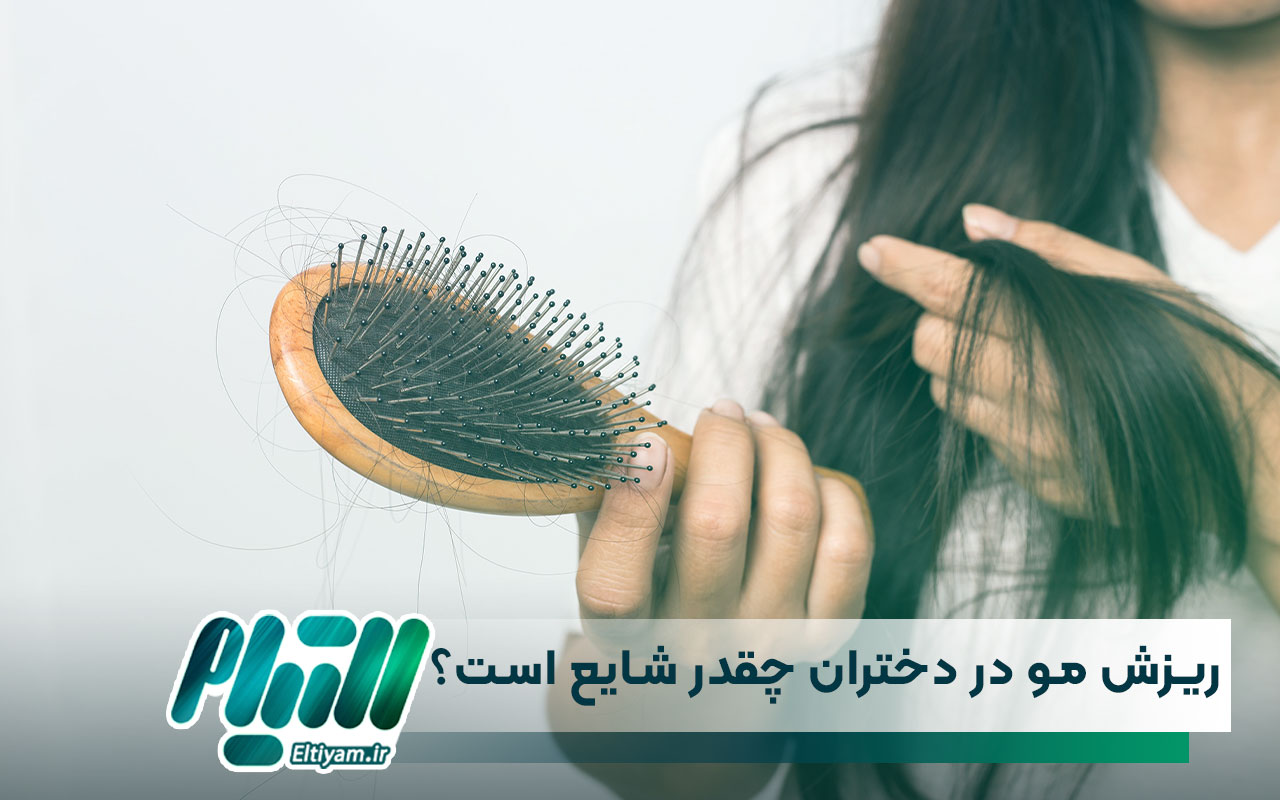 ریزش مو در دختران چقدر شایع است؟