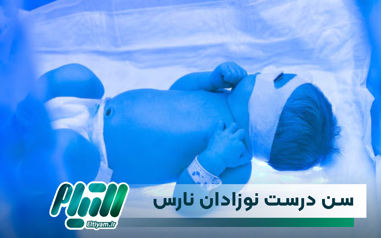 سن درست نوزادان نارس