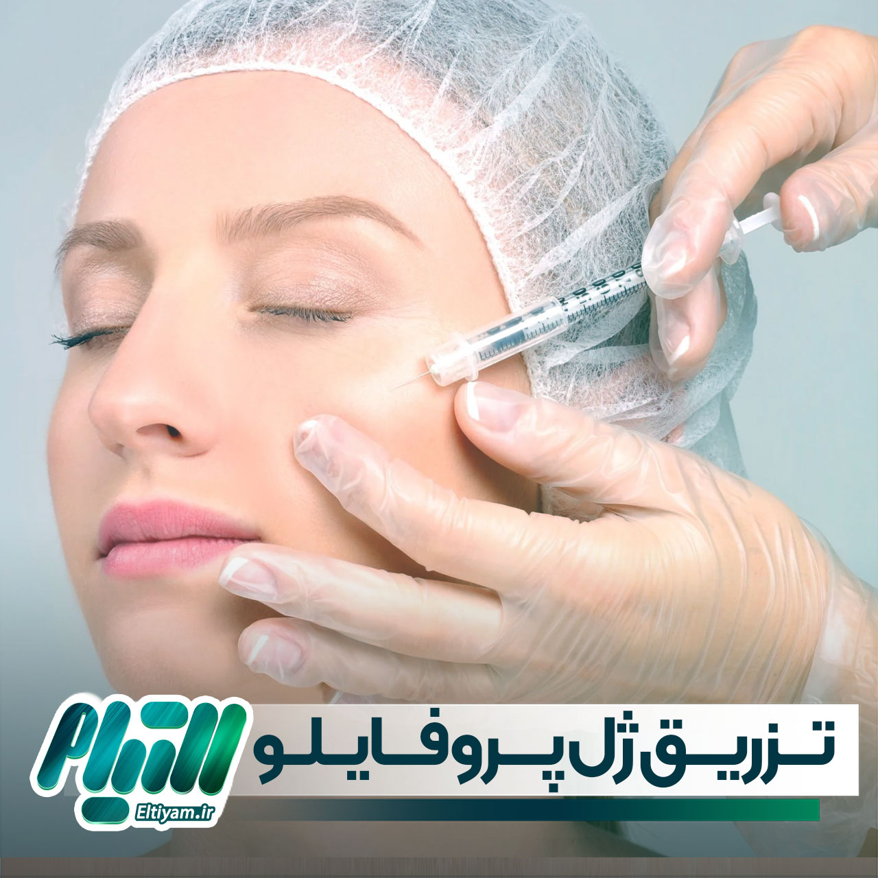 تزریق ژل پروفایلو