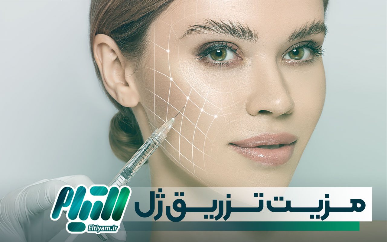 مزیت های تزریق ژل پروفایلو