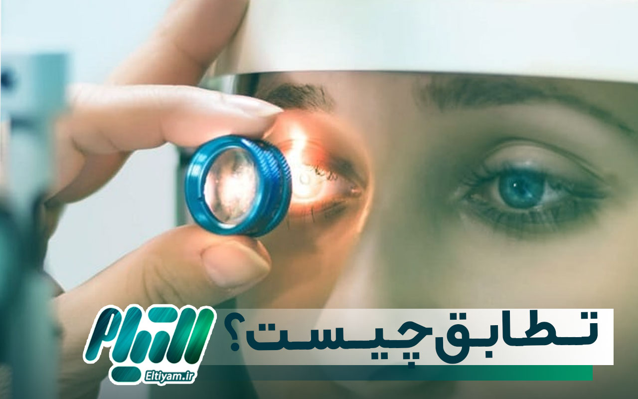 تطابق چیست؟
