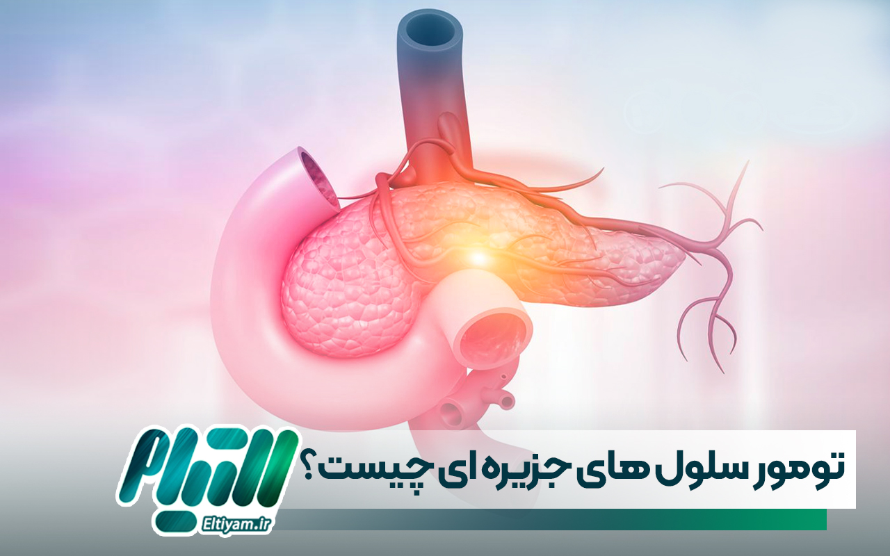 تومور سلول های جزیره ای چیست؟