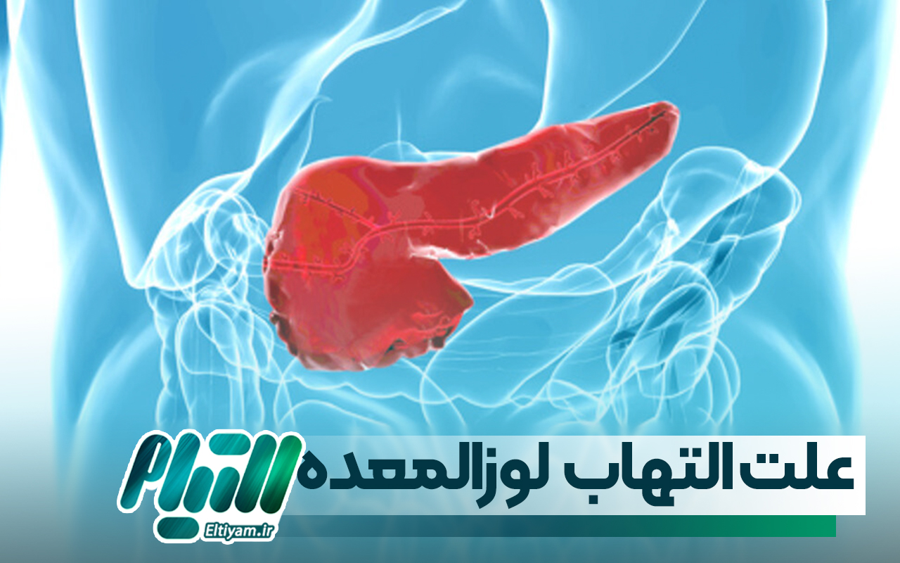 علت بیماری التهاب لوزالمعده