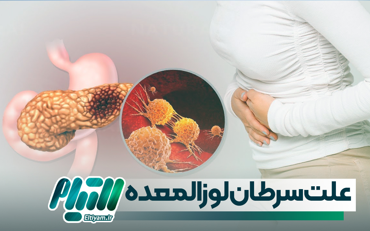 علت سرطان لوزالمعده چیست؟
