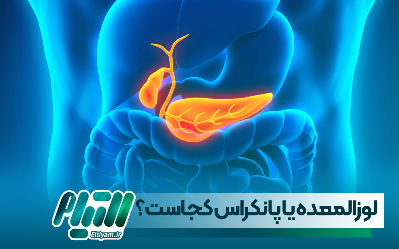 لوزالمعده یا پانکراس کجاست؟