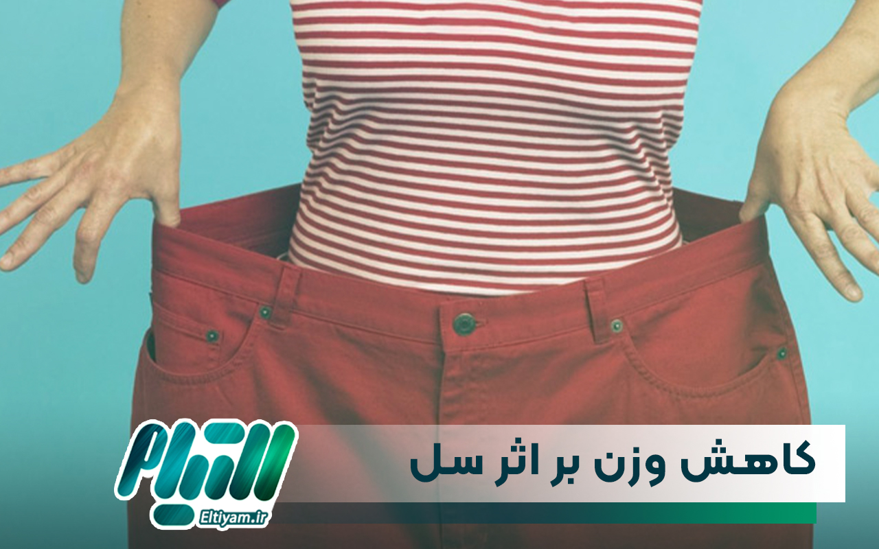 کاهش وزن ناگهانی بر اثر بیماری سل
