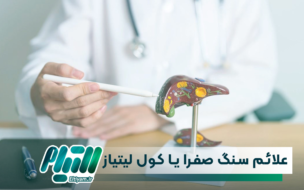 علائم سنگ صفرا یا کول لیتیاز
