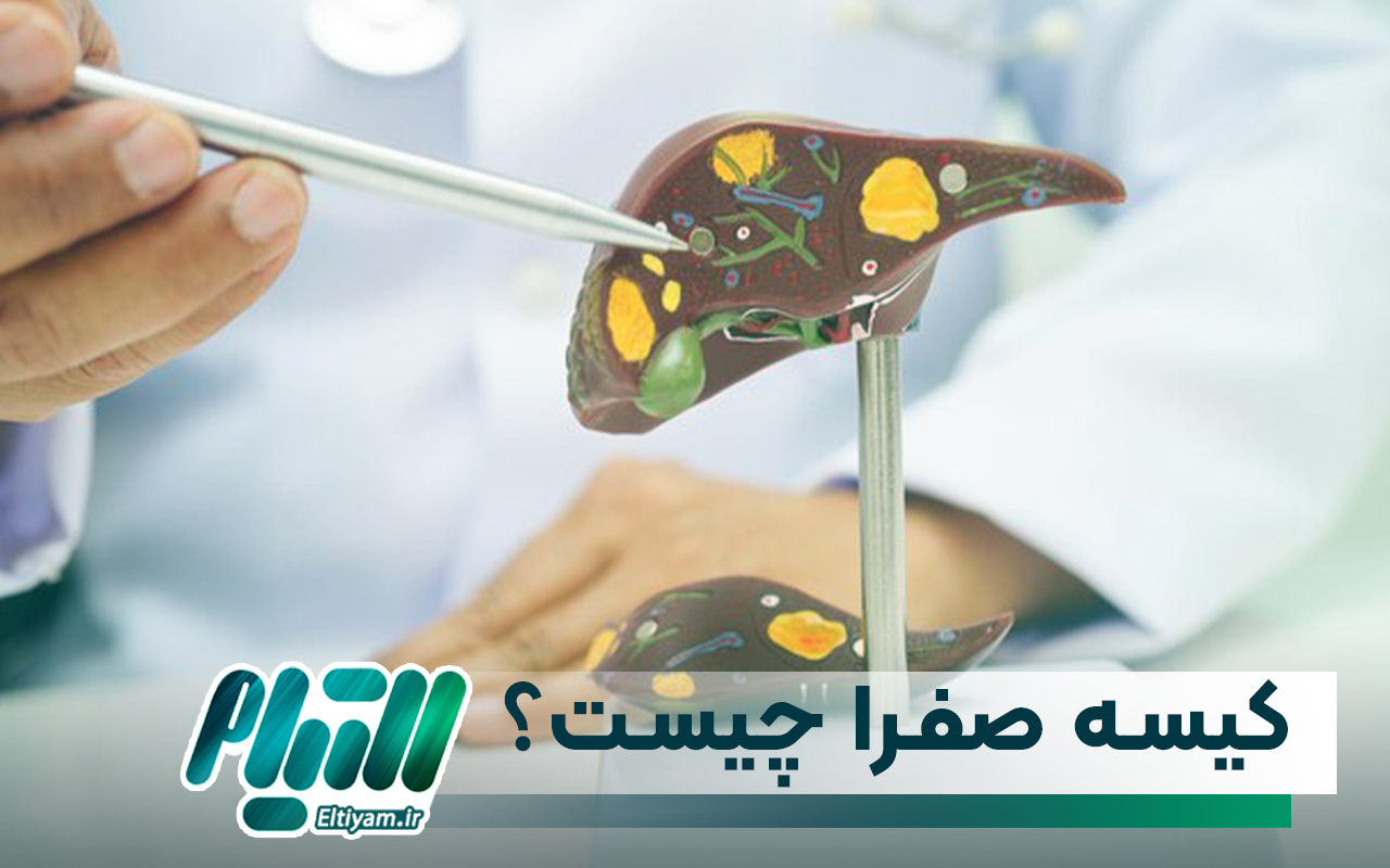 کیسه صفرا چیست؟