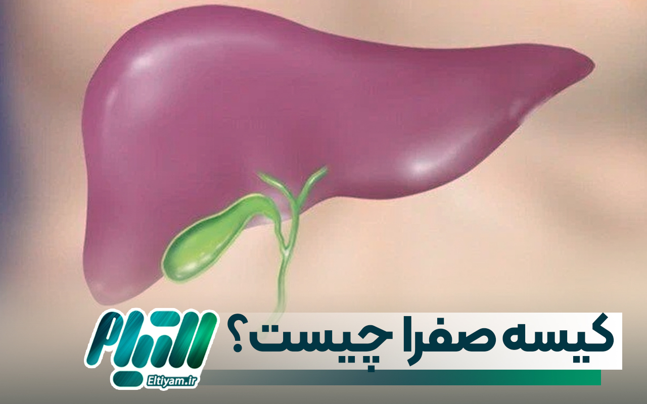 کیسه صفرا چیست؟