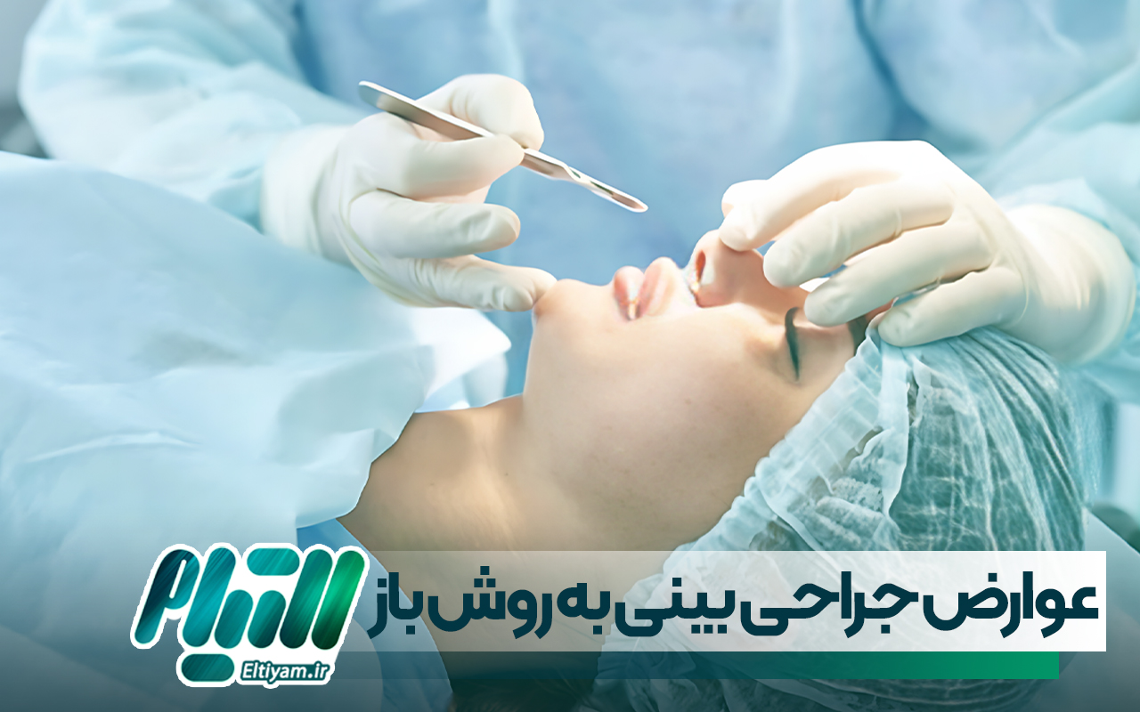 عوارض جراحی بینی به روش باز