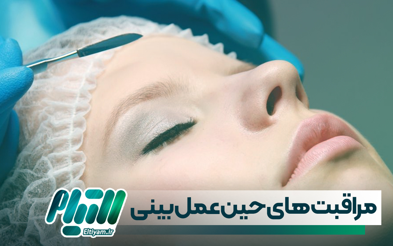 چه کسانی حین عمل بینی نیاز به مراقبت بیشتر دارند؟