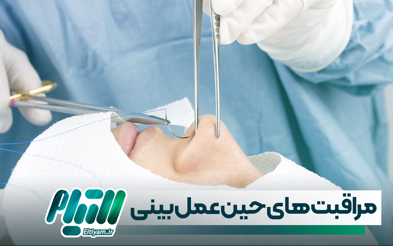 ضرورت انجام مراقبت های حین عمل بینی