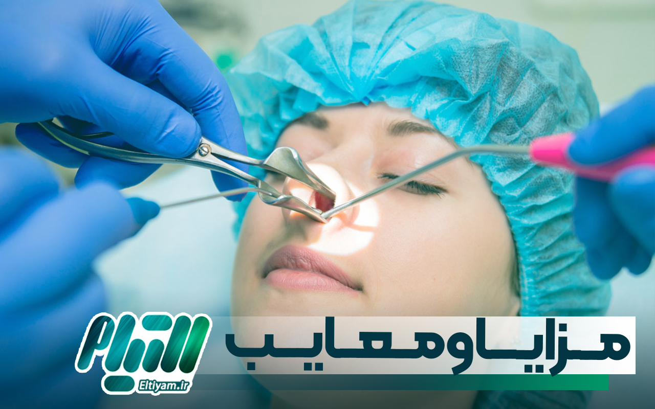 مزایا و معایب جراحی بینی به روش باز