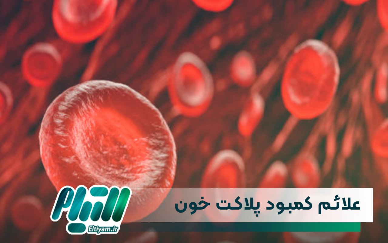 علائم کمبود پلاکت خون در کودکان