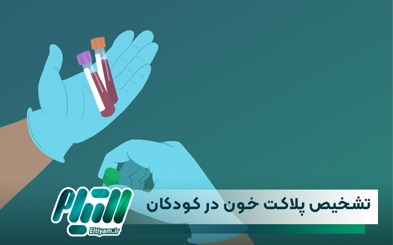 آزمایش و تشخیص پلاکت خون در کودکان