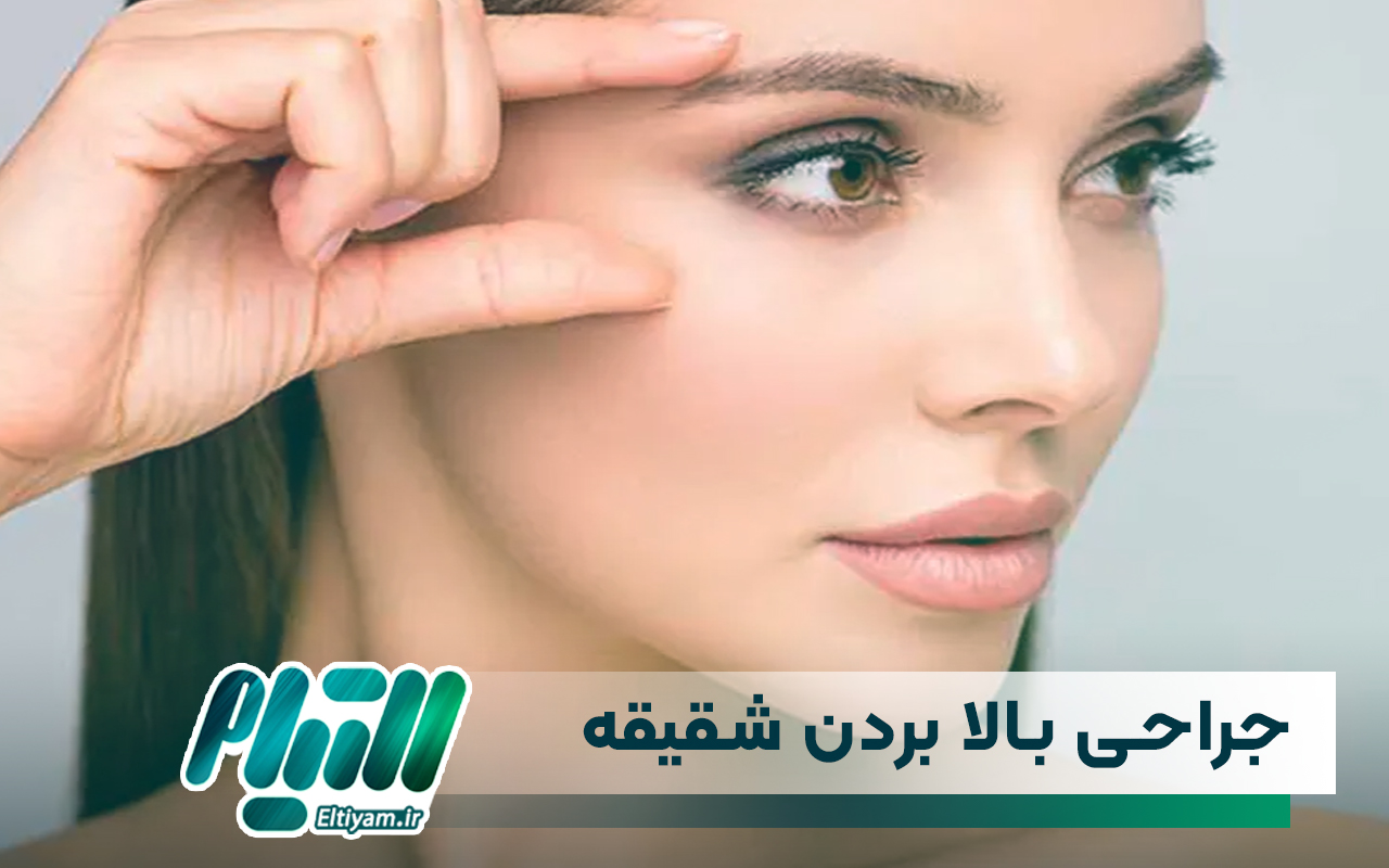 جراحی بالا بردن شقیقه برای چه کسانی مناسب است؟