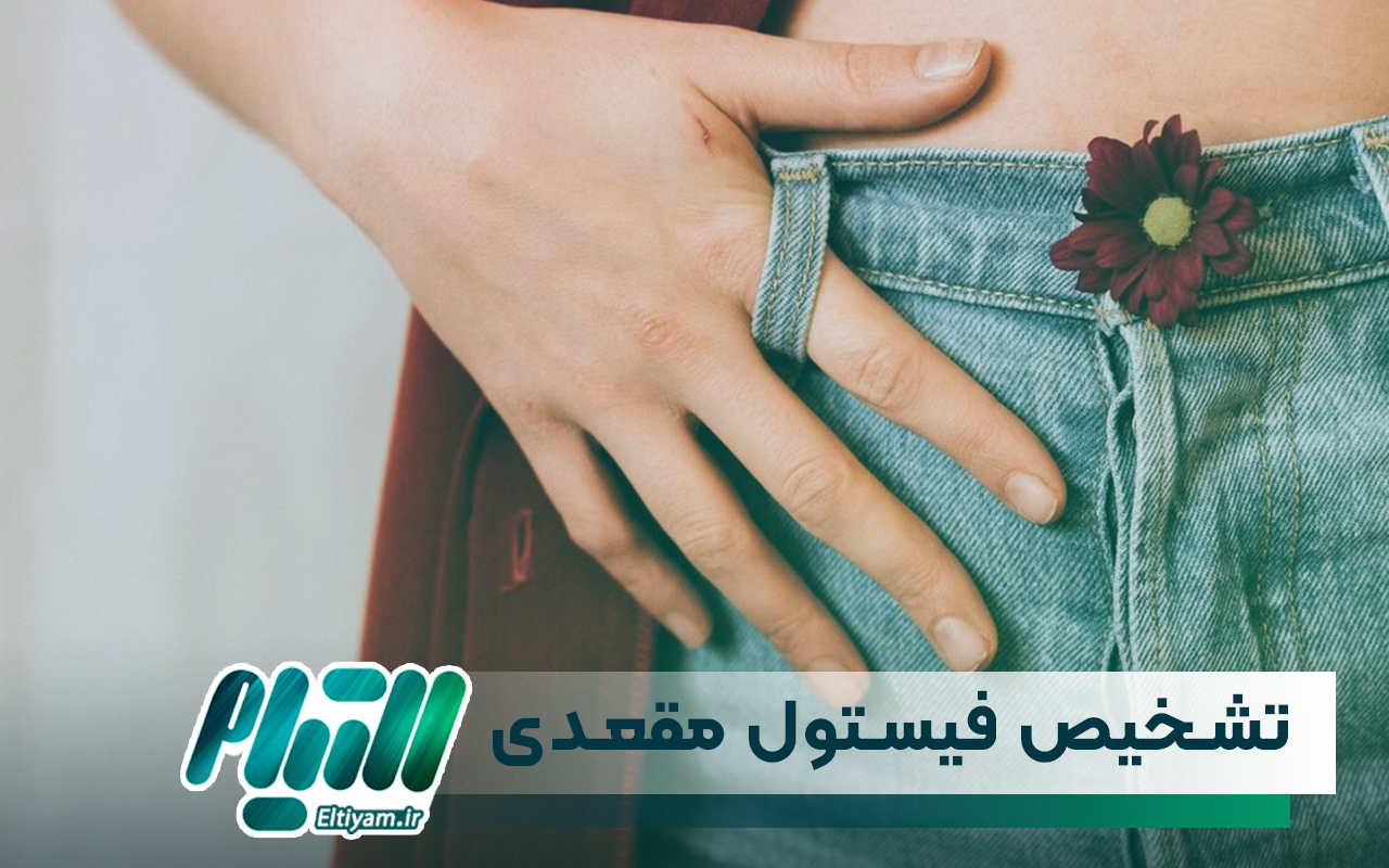 تشخیص فیستول مقعدی