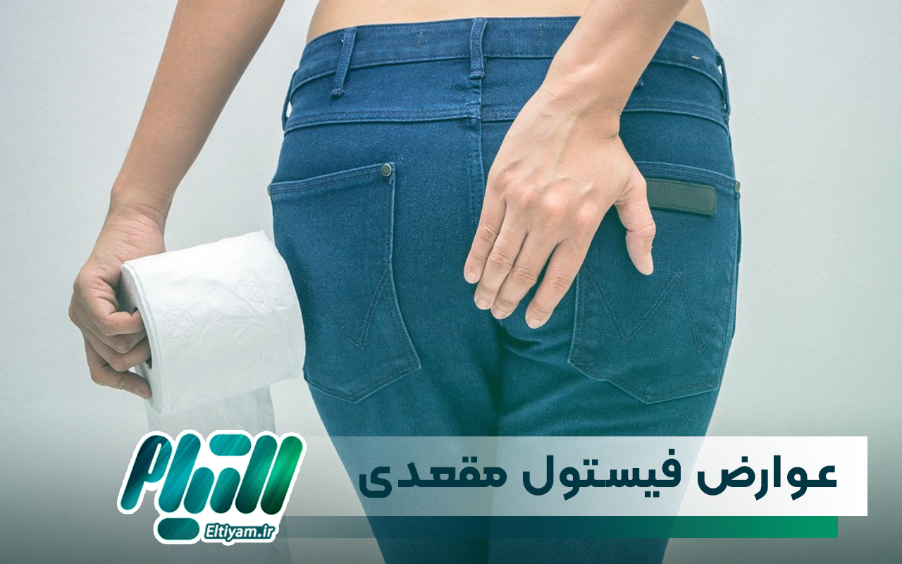 عوارض فیستول مقعدی